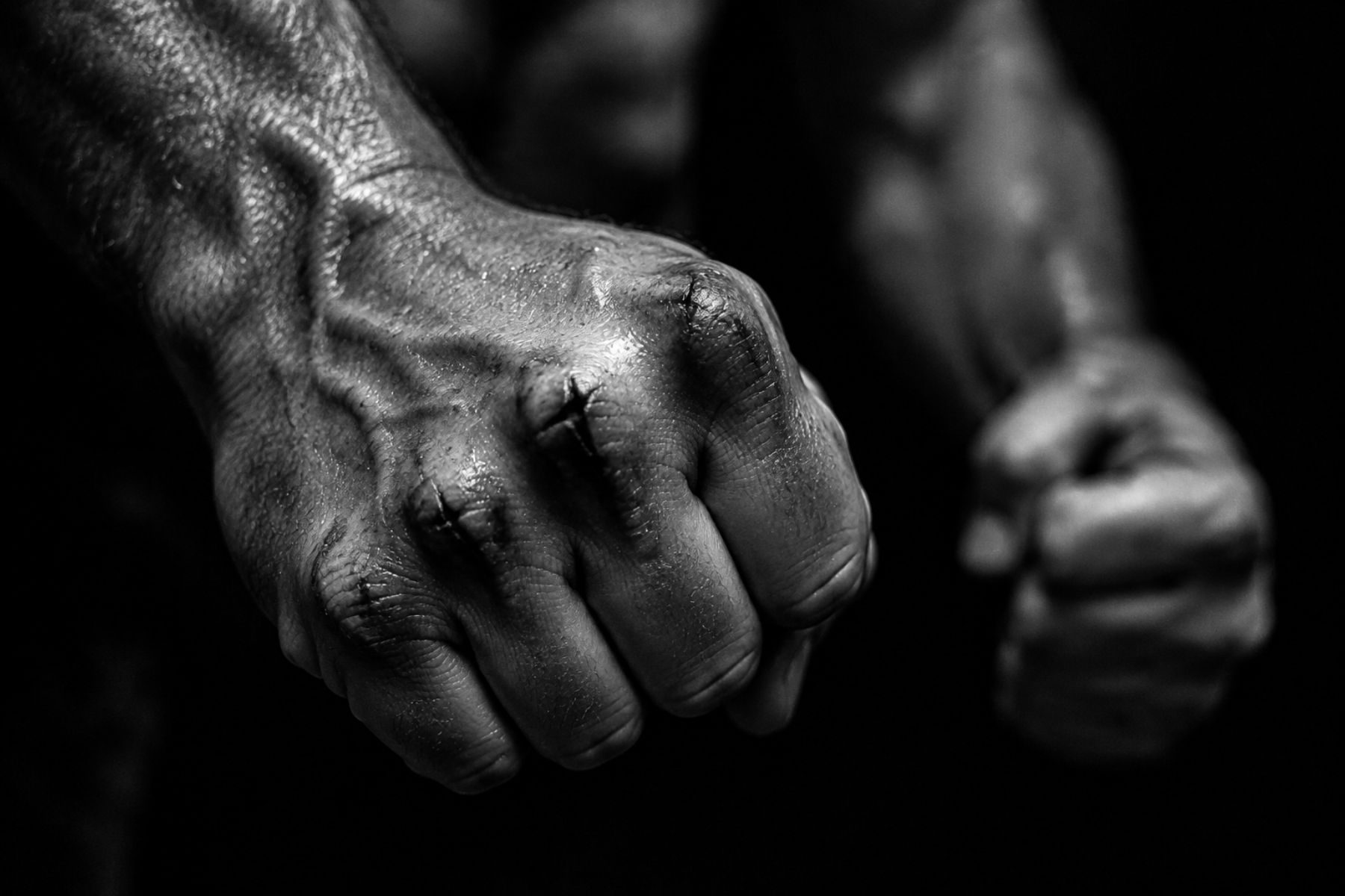Black and white photo: a clenched fist with split knuckles